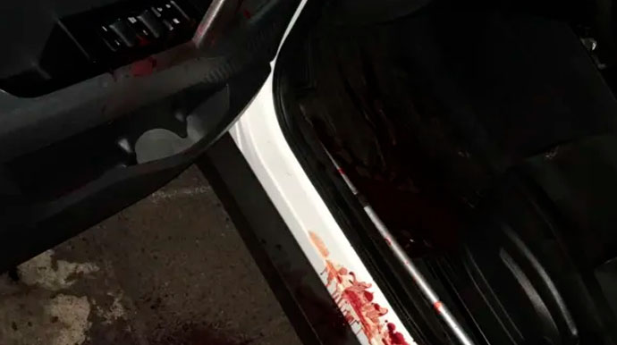 Divulgação - Veículo ficou com marcas de sangue após a agressão - Foto: Reprodução/Jornal da Segunda